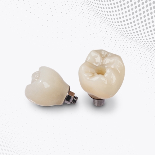 Sứ trên Implant